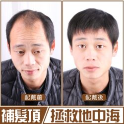男士半手織補髮塊【真髮】【15*18】【F15】☆ 頭髮稀疏、高額頭、M型禿、遮白髮、頭頂補髮